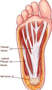 足底筋膜