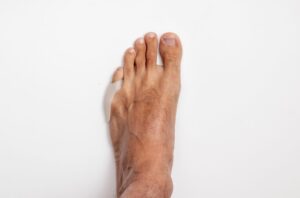 小指セパレーター